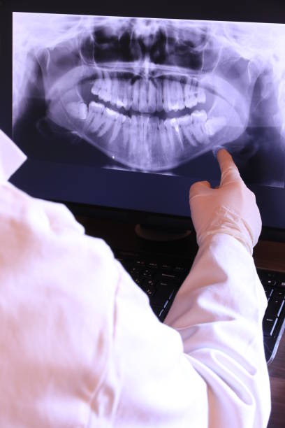 Best Emergency Dentist for Knocked-Out Tooth in Mechanicstown, NY