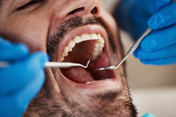 Best Pediatric Emergency Dentist in Mechanicstown, NY