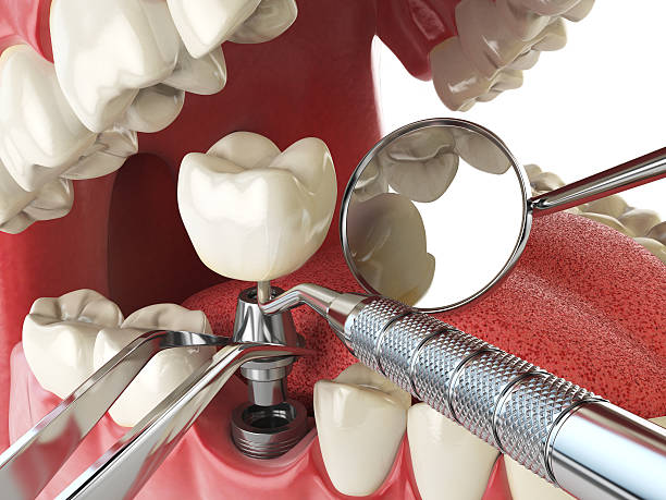 Best Emergency Dental Services for Seniors in Mechanicstown, NY